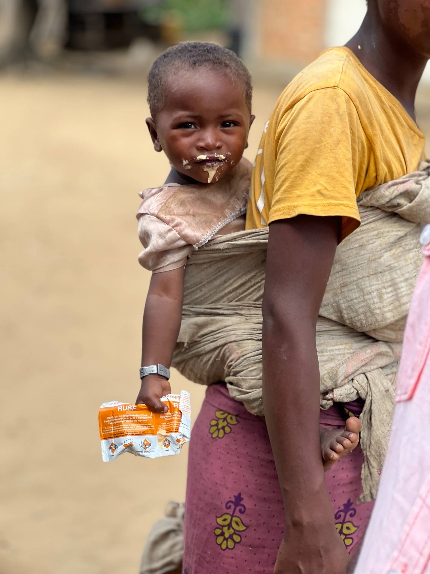 Child receiving RUSF at the community health centre