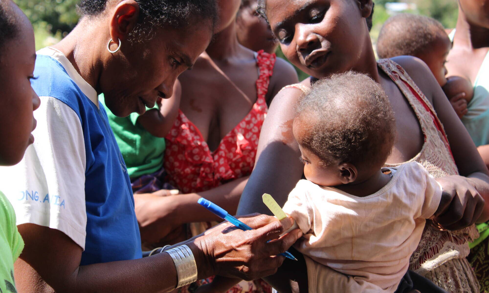 Measuring malnourished children at a rural health clinic in Anosy region